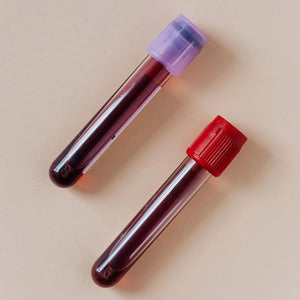 Advanced Longevity Blood Test - (For women)